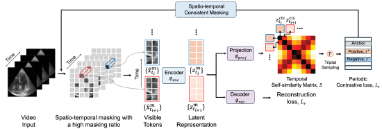 EchoFM: Foundation Model for Generalizable Echocardiogram Analysis