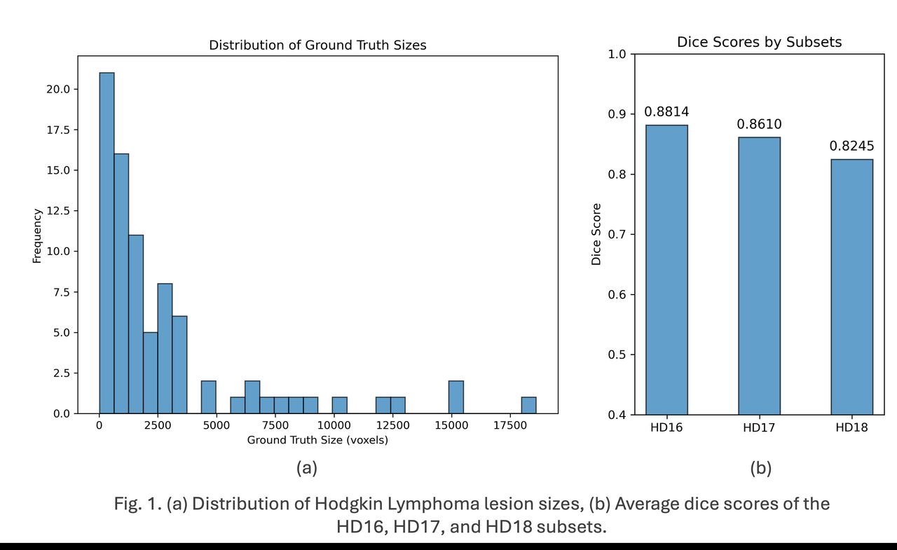 Hodgkin Lymphoma-Based Intensity Preprocessing and Foundation Model-Based Automated Segmentation